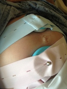 The Belly Monitors